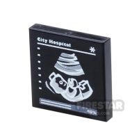 Product shot Custom Printed Tile 2x2 Baby Ultrasound Scan